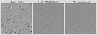 The same field of cells, tracked through the run in brightfield, as the agent saw them live (identical processing across all three frames). At baseline the cells are healthy and well spread; after the 2M NaCl dose the cytoplasm turns refractile and the field flattens; after the rescue the texture returns and the cells look like the baseline again. The live cell count held steady (around 210–215) throughout: the change was real, and it reversed.